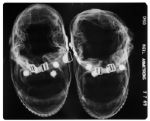 Four X-Ray Radiographs of Apollo 11 Items Worn by the Astronauts & Left on the Moon -- Radiographs Were Taken by NASA Nine Days Before the Apollo 11 Launch