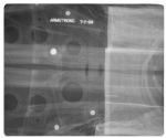 Four X-Ray Radiographs of Apollo 11 Items Worn by the Astronauts & Left on the Moon -- Radiographs Were Taken by NASA Nine Days Before the Apollo 11 Launch