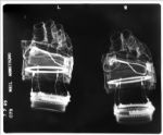 Four X-Ray Radiographs of Apollo 11 Items Worn by the Astronauts & Left on the Moon -- Radiographs Were Taken by NASA Nine Days Before the Apollo 11 Launch