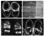 Four X-Ray Radiographs of Apollo 11 Items Worn by the Astronauts & Left on the Moon -- Radiographs Were Taken by NASA Nine Days Before the Apollo 11 Launch